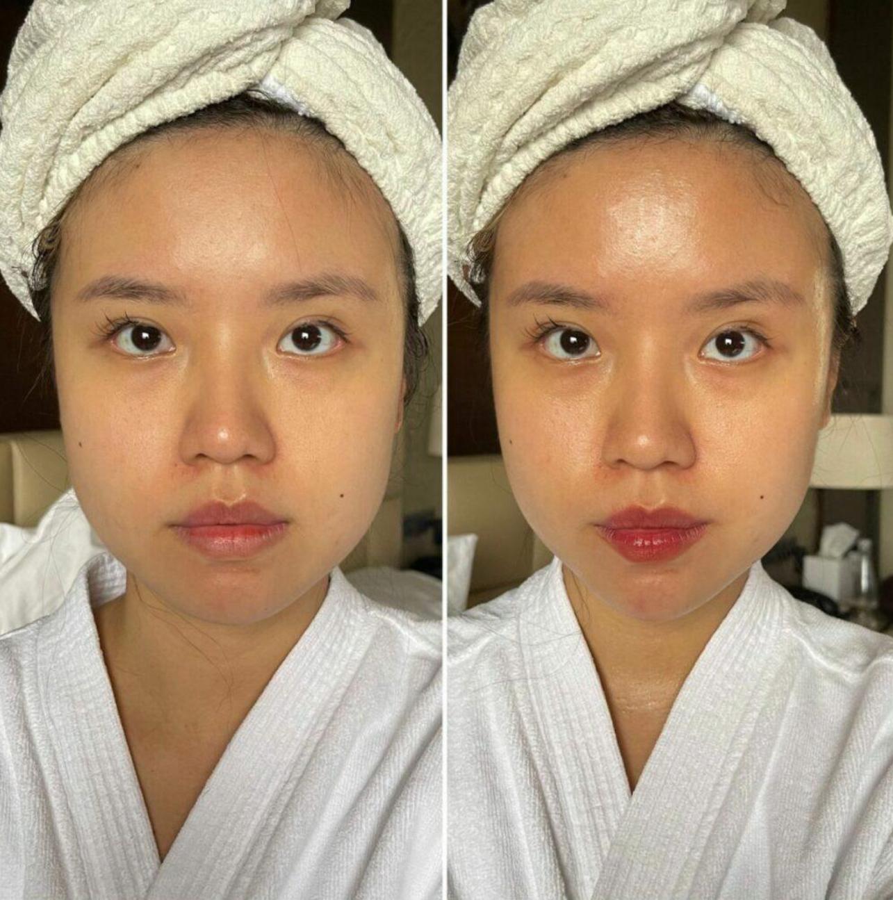 EMS Facial Pro